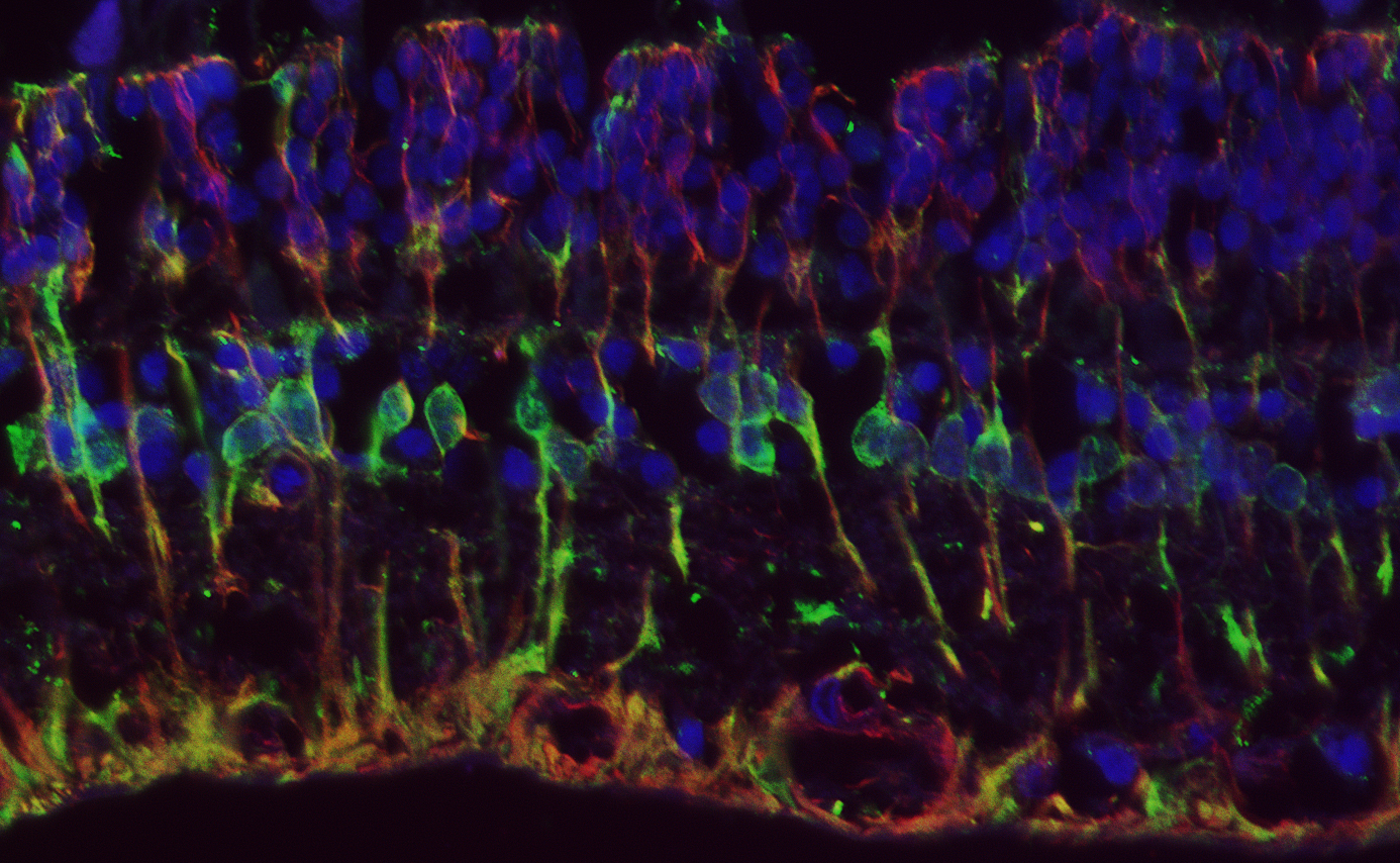 Internal view of a retina, courtesy of the Brandt Lab